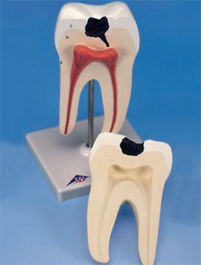 sezione di dente